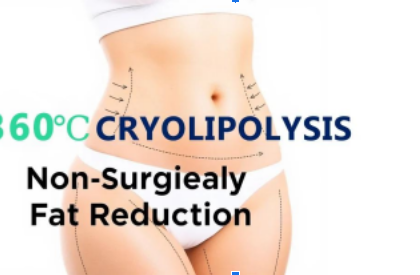 unlock-your-dream-body:-the-revolutionarypower-of-360-cryolipolysis-weight-lossmachine